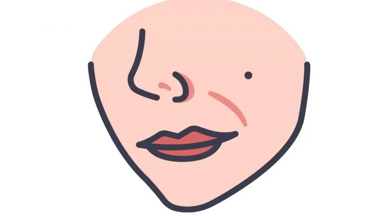 What Do Moles On Your Face Mean